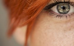 Freckle, Pigmentation, Rosacea, Broken Capillaries